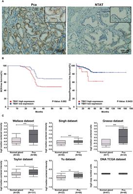 TBX1 Functions as a Tumor Activator in Prostate Cancer by Promoting Ribosome RNA Gene Transcription